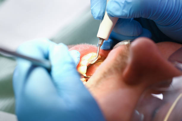 Best Emergency Dental Care for Abscessed Tooth in Leonard, TX